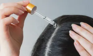 Eine Hand trägt mit einer Pipette ein Öl auf die Kopfhaut auf. Ein natürliches hausmittel gegen schuppen und juckende kopfhaut.