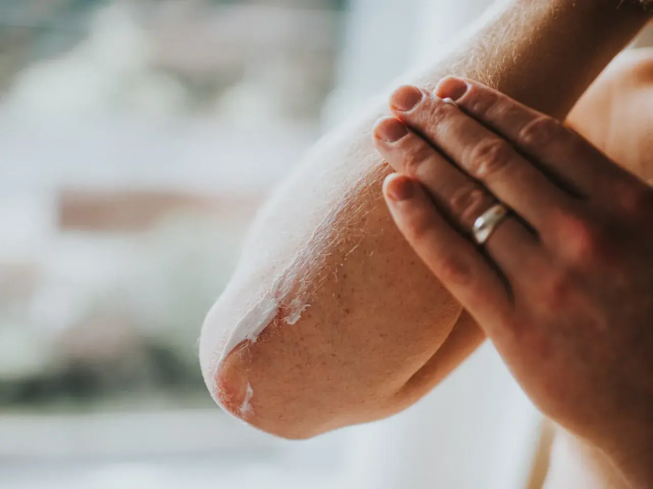 Hand cremt Ellenbogen ein, um trockene Haut zu pflegen. Die Haut ist gerötet und schuppig, die Creme spendet Feuchtigkeit.
